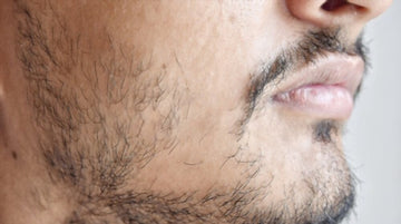 How to Fix a Patchy Beard - Reasons & Solution
