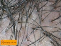 As I Am Dry & Itchy Scalp Care Olive And Tea Tree Oil Cowash